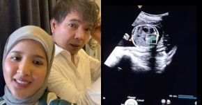 nur nilam hamil anak pertama