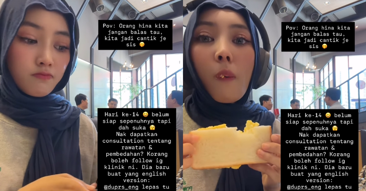 “Bedah Mata & Hidung Ke?” – Lama Menghilang, ‘Wajah’ Terbaru Kim Seri Jadi Perhatian