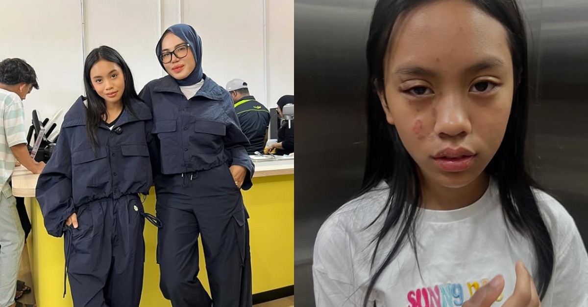 “Thalita Ada Buat Dosa Dengan Mummy Ke, Kenapa Allah Bagi Thalita Sakit Ni..” – Watie Hanifiah Menggetar Lihat Thalita Melecur Kena Minyak Panas