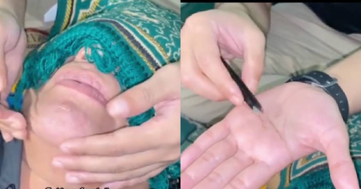 (VIDEO) Pengamal Perubatan Islam Dedah Artis Lelaki Pakai Susuk Emas, Cuba Buang Tapi Gagal – “Jarum Tak Nak Keluar…”