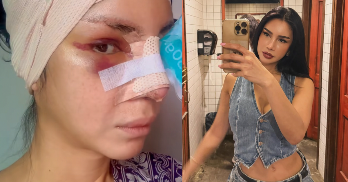 “Ia Bukan Soal Lawan Agama Tetapi Sayangi Diri Sendiri” – Sajat ‘Show-Off’ Buat Hidung, Netizen Mohon Segera Taubat