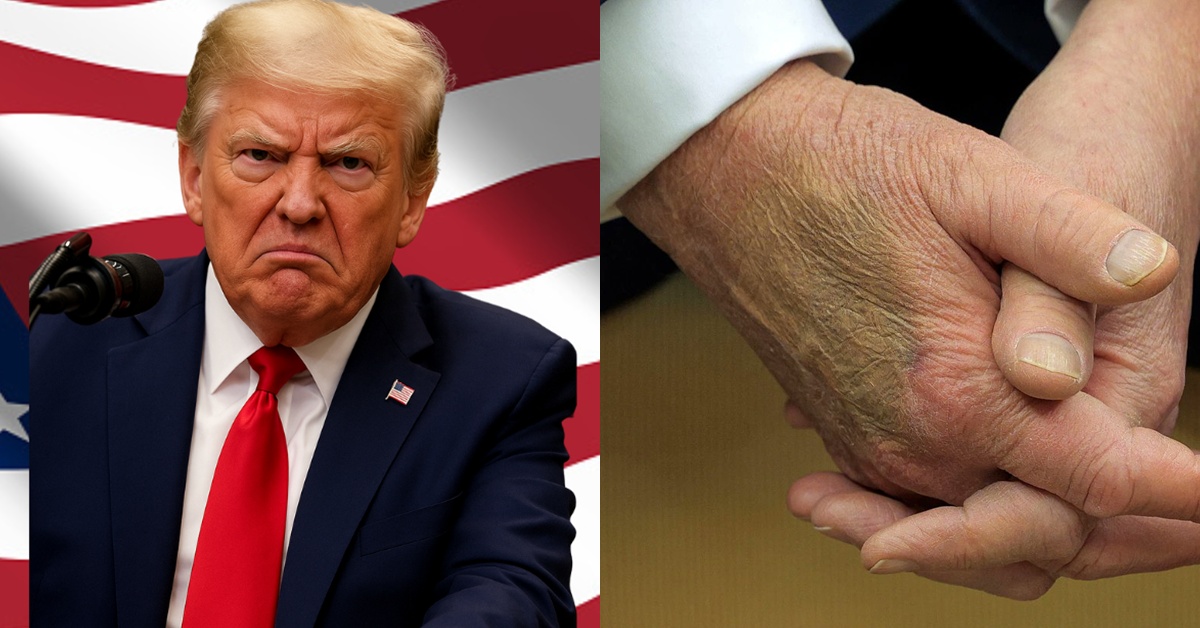 Didiagnos Hidap Penyakit & ‘Hilang’ Beberapa Hari, Donald Trump Didakwa Sudah ‘Tiada’?