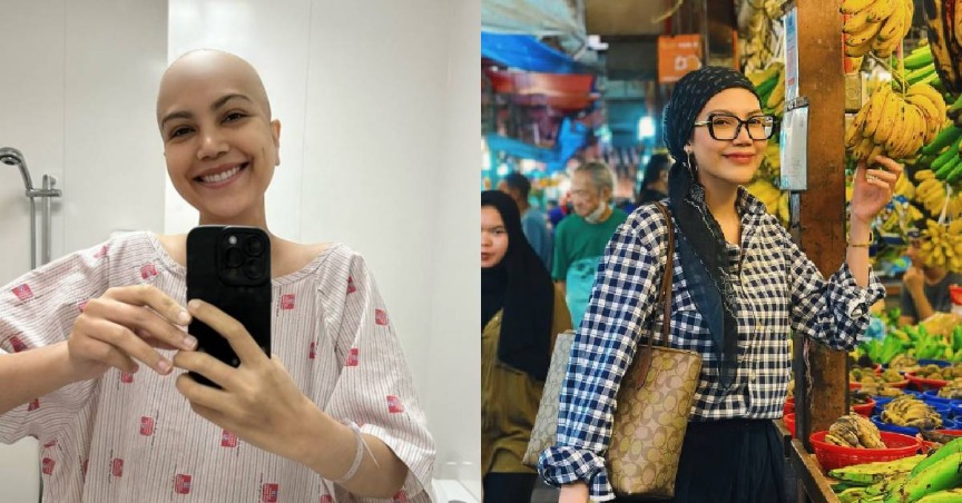 Elyana Muat Naik Foto Kepala Botak, Beri Inspirasi Buat Pesakit Kanser – “Ini Bukan Untuk Raih Simpati Tapi..”