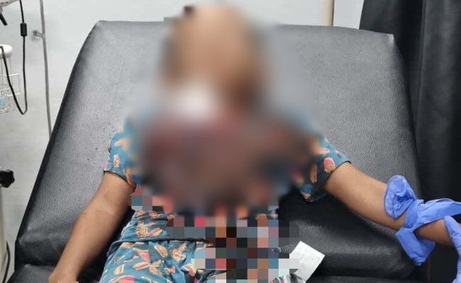 adik dikelar abang sendiri