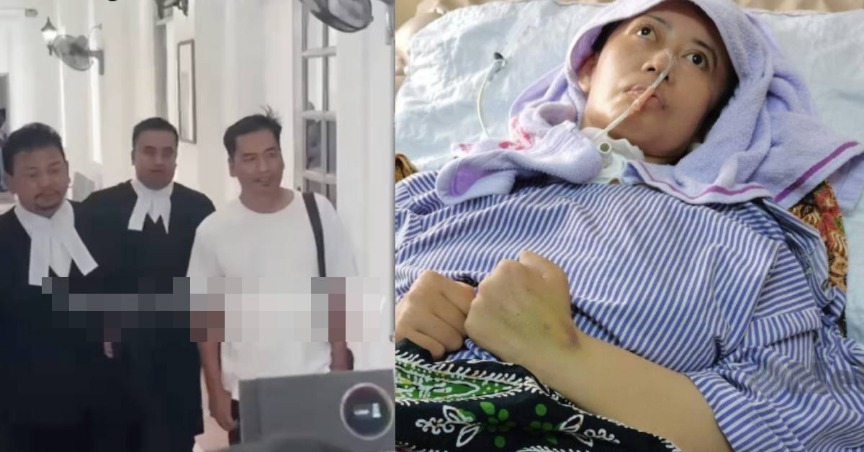 Belasah Isteri Hingga Koma & Cacat Kekal, Bekas Suami Jahidah Kekal Penjara 10 Tahun