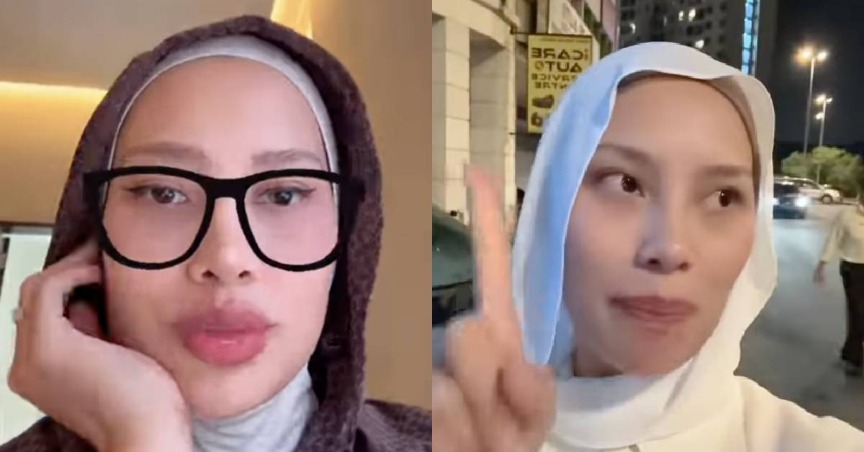 “Ramai Yang Terkesan Isu Laser Fef*k, Biar Aku Je Cantik Sorang” – Sasha Aziz
