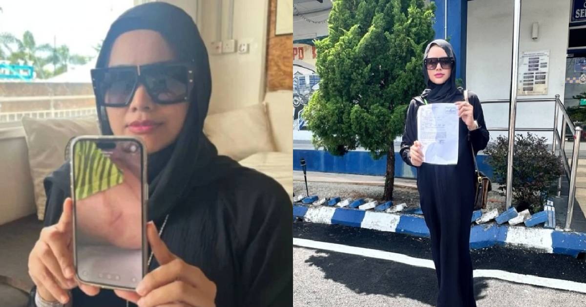 Usahawan Kosmetik Dakwa Anak Dipuk*l Bekas Tunang, Dicek*k Dan Ditendang Seluruh Badan