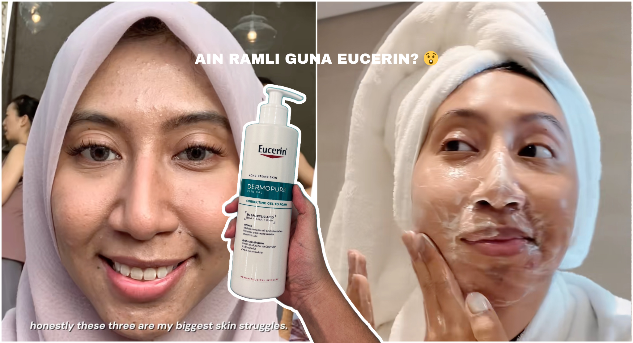 “Setakat Ni, Review Dia Nampak Paling Legit”- Siapa Tengah Cari Produk Penjagaan Dengan Asid Salisilik Kena Tengok INI….