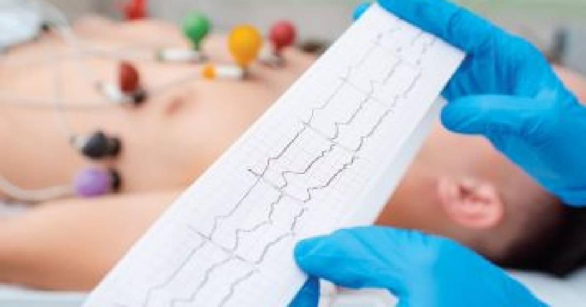 “Tergamam Aku” – Wanita Kongsi Pengalaman ‘Check’ ECG, Terpaksa Buka Pakaian Dalam