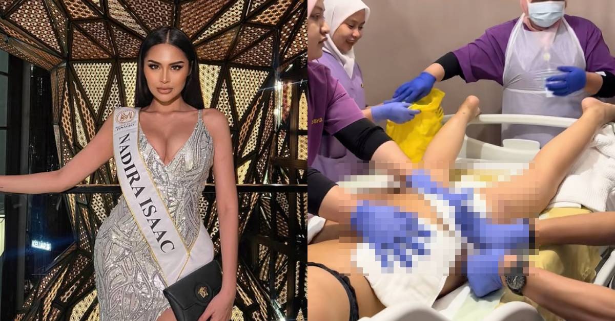 Model Nadira Isaac Ambil Keputusan Buang ‘Filler’ Di Punggung Dan Buah Dada – “Alhamdulillah Kembali Bentuk Asal..”