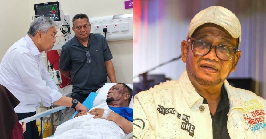 Datuk Nash Kemalangan Motosikal Selepas Pulang Menunaikan Solat Isyak, Terima 52 Jahitan